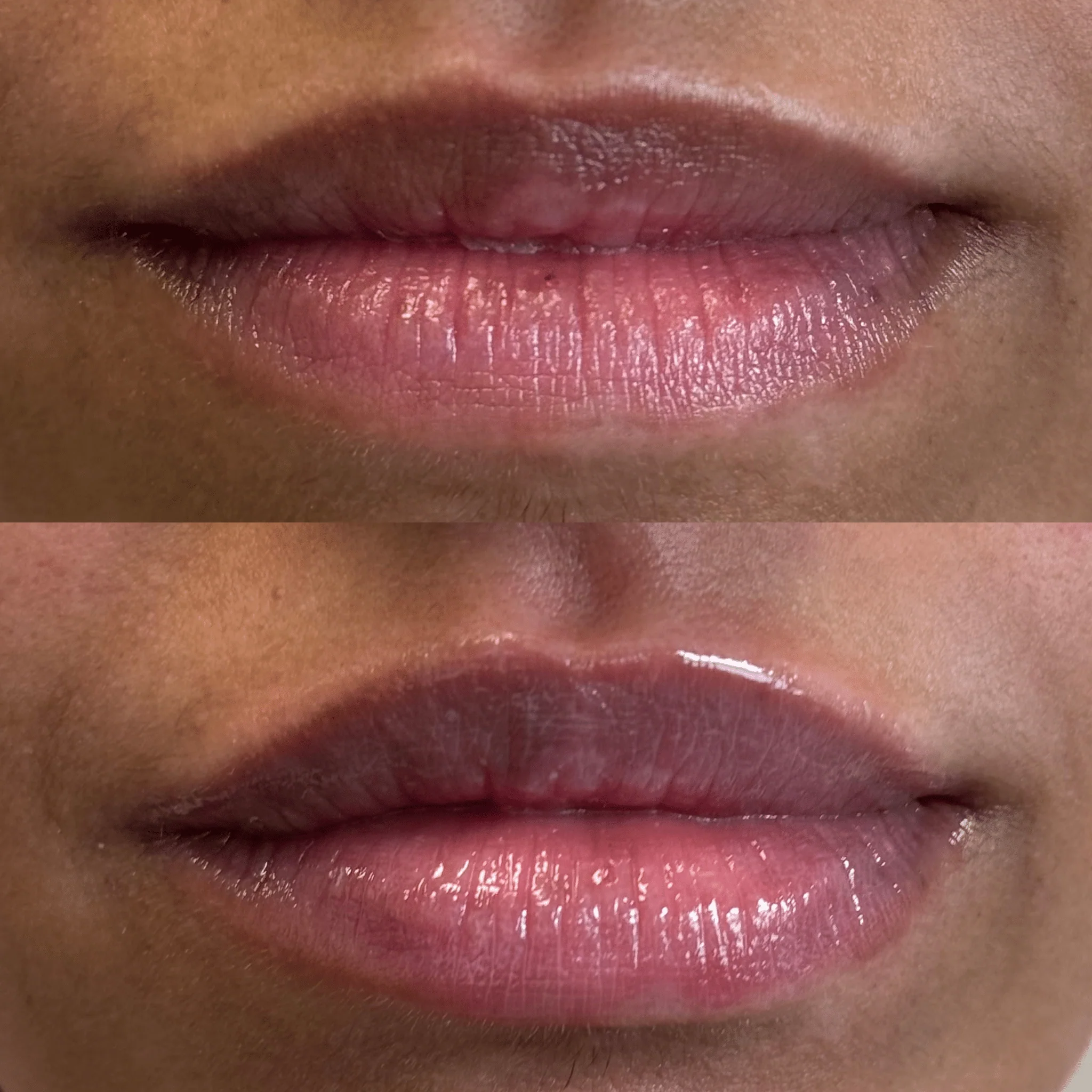 Lip Plumper - Image 4