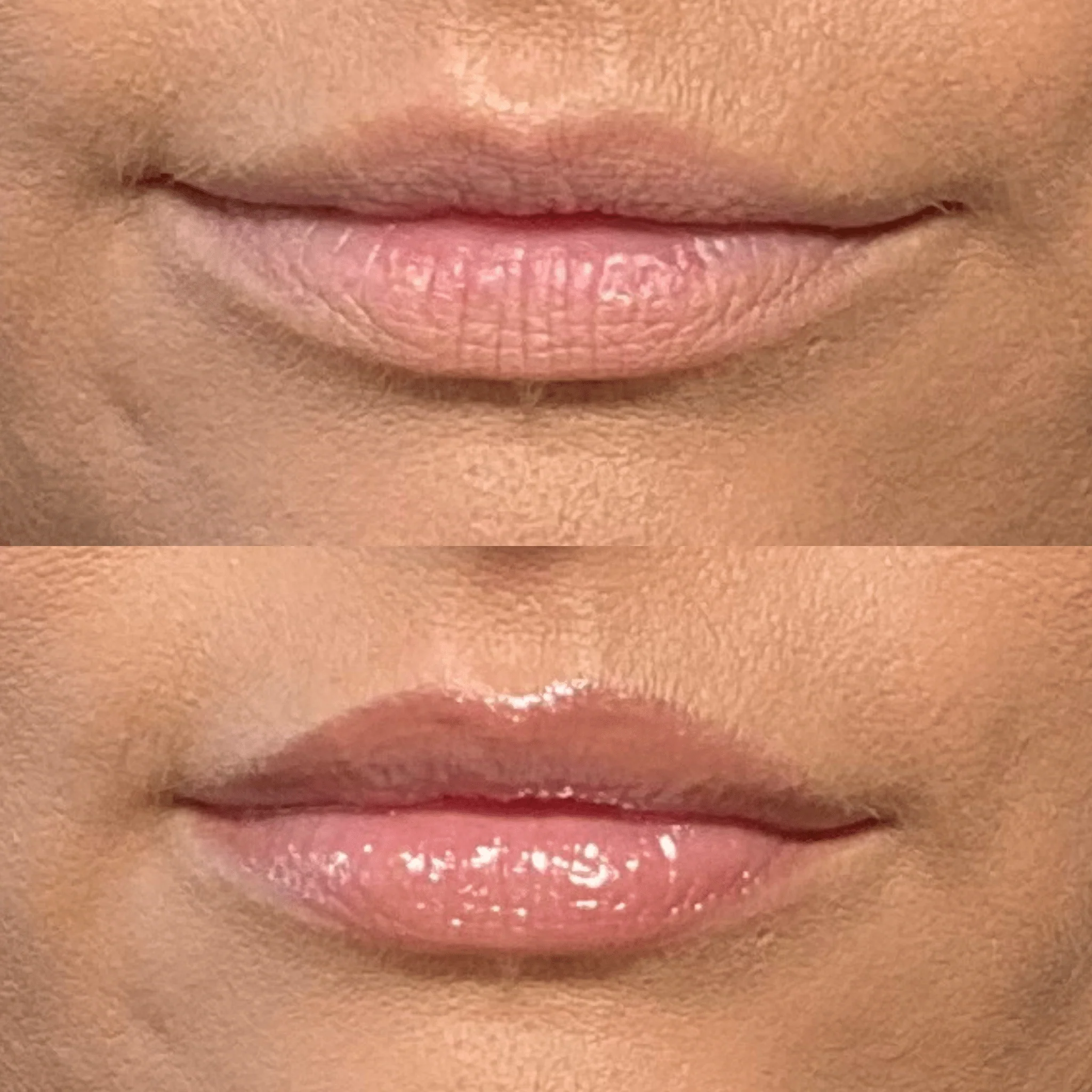 Lip Plumper - Image 5