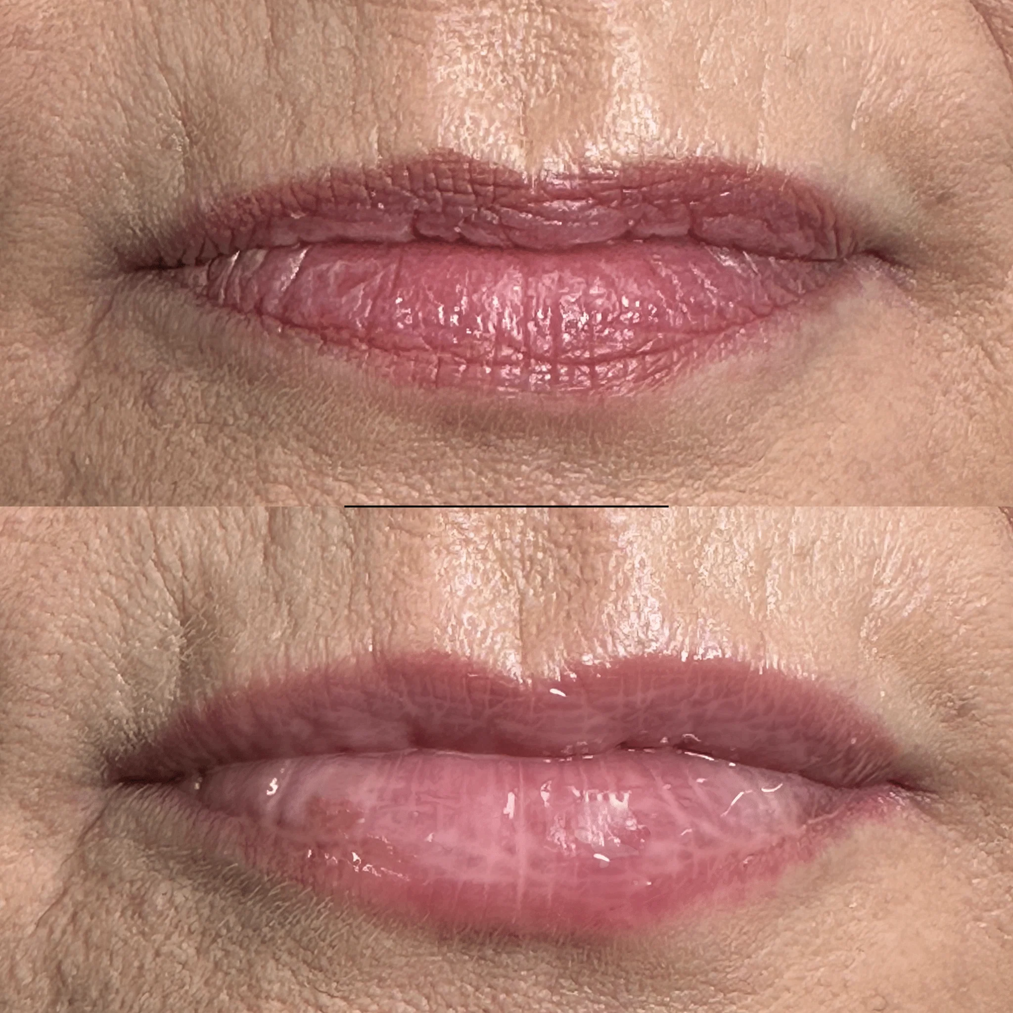 Lip Plumper - Image 3